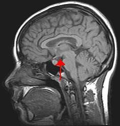 Hypothalamus controls the pituitary gland.