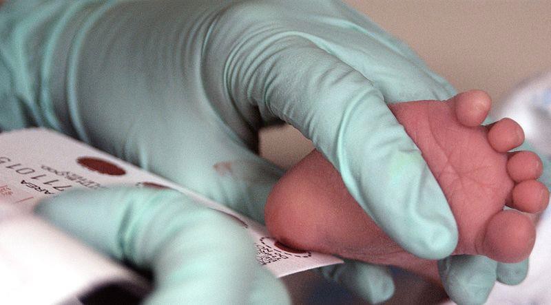 A medical professional performing the heel stick test.