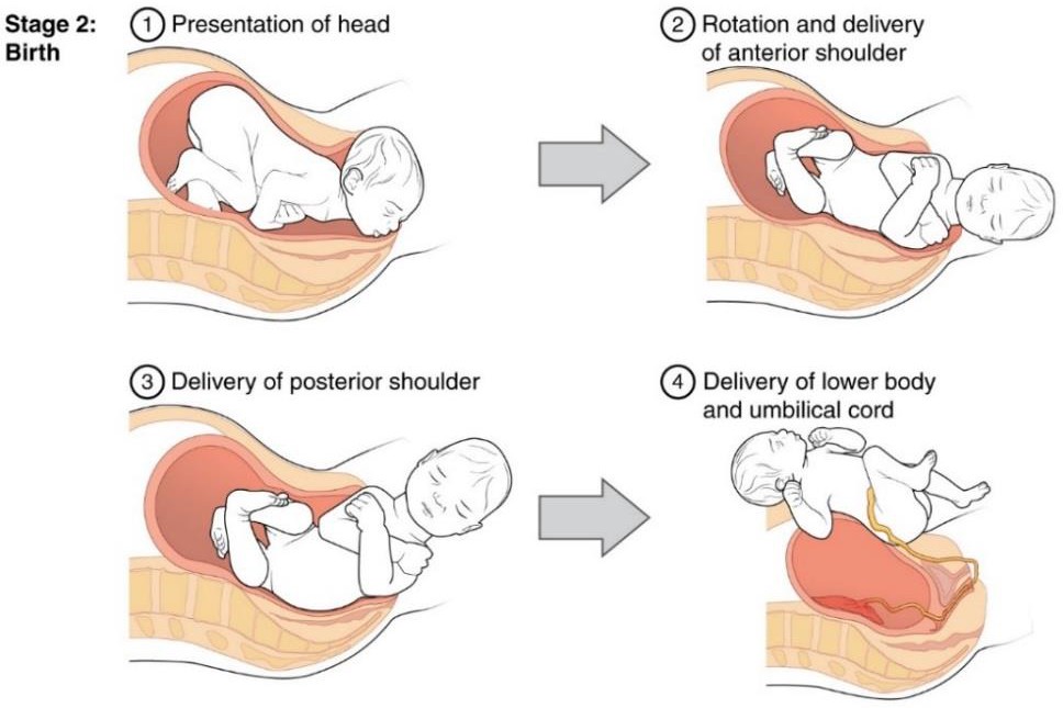 Full dilation and expulsion of the newborn.