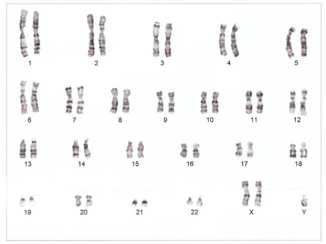 The 23 pairs of chromosomes.