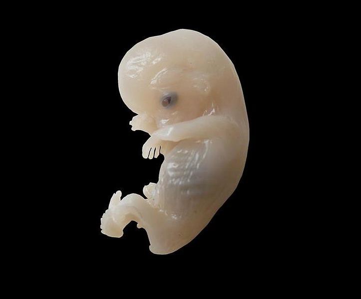 A human embryo.